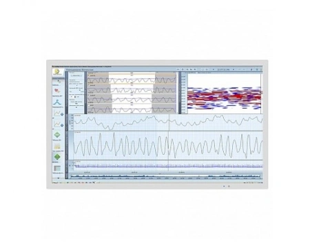 ЭКГ Medilog® DARWIN