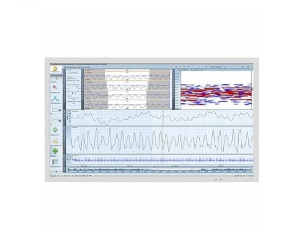 ЭКГ Medilog® DARWIN