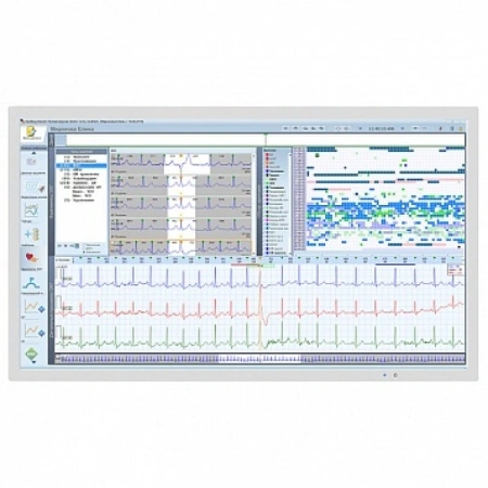 ЭКГ Medilog® DARWIN